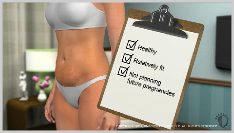alt-Miniabdominoplastia