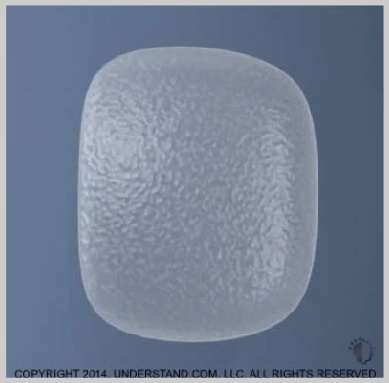 Implantes peitorai