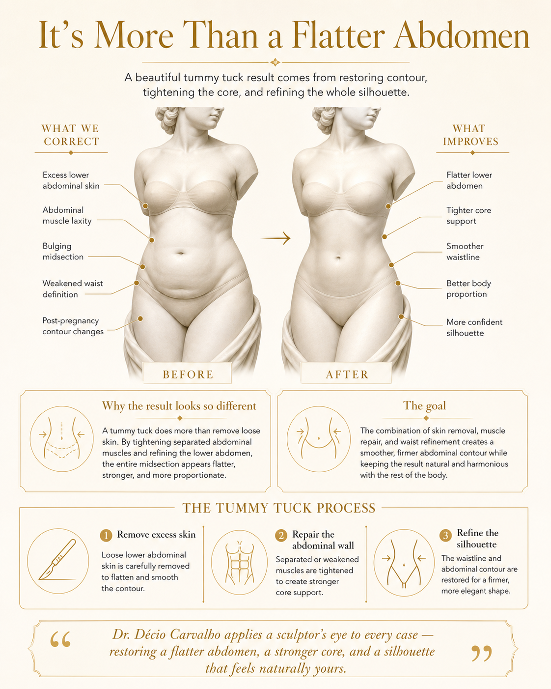Ilustración antes y después de la abdominoplastia: cómo la remoción de piel y la tensión muscular remodelan el abdomen.