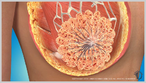 Breast-Augmentation-Silicone-ANATOMY