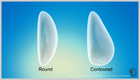 Breast Augmentation with Silicone Implants