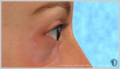 Eyelid-Surgery-Lower-WHAT-CAUSES-EYELIDS-TO-CHANGE