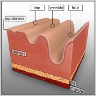Dentro del tejido conectivo de la dermis, el colágeno y las fibras de elastina forman una red, otorgándole a la piel estructura, soporte y elasticidad. Además, las células grasas y otras moléculas, como el ácido hialurónico, contribuyen a la creación de volumen por debajo de la piel del rostro. Con el transcurso del tiempo, esta red de colágeno y elastina se rompe, y las moléculas de ácido hialurónico y las células grasas que crean volumen se reducen. El hecho de que estas moléculas se rompan y se reduzcan al mismo tiempo provoca la aparición de arrugas y otros cambios en la piel del rostro. Cuando se utilizan como tratamientos únicos o junto con otros procedimientos, los rellenos inyectables pueden reducir o eliminar arrugas y cicatrices, crear labios más rellenos y tratar la lipoatrofia, o la pérdida de grasa debajo de la piel.