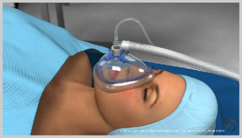 Tummy-Tuck-Mini-PREPARATION