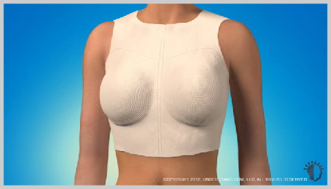 breast-augmentation-saline-implants-RECOVERY-OF-BREAST-IMPLANTS