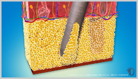 fat-transfer-2-¿CÓMO FUNCIONA?